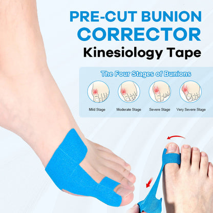 ✨Bär alla skor du älskar – utan smärta från hallux valgus👠💃