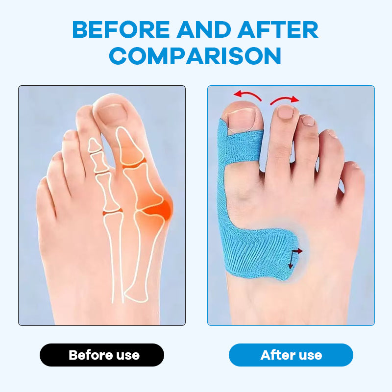 ✨Bär alla skor du älskar – utan smärta från hallux valgus👠💃