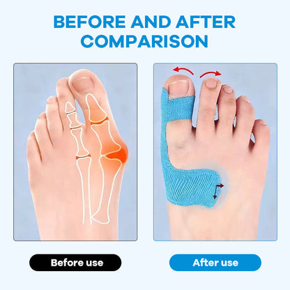 ✨Bär alla skor du älskar – utan smärta från hallux valgus👠💃